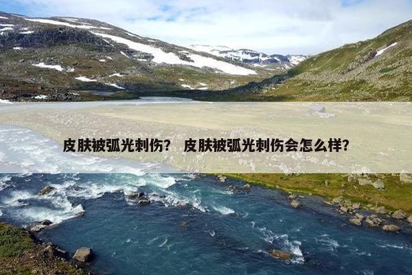 皮肤被弧光刺伤？ 皮肤被弧光刺伤会怎么样？